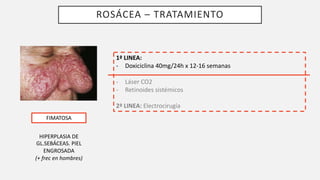 ROSÁCEA – TRATAMIENTO
FIMATOSA
HIPERPLASIA DE
GL.SEBÁCEAS. PIEL
ENGROSADA
(+ frec en hombres)
1ª LINEA:
- Doxiciclina 40mg/24h x 12-16 semanas
- Láser CO2
- Retinoides sistémicos
2ª LINEA: Electrocirugía
 