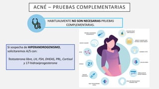 ACNÉ – PRUEBAS COMPLEMENTARIAS
HABITUALMENTE NO SON NECESARIAS PRUEBAS
COMPLEMENTARIAS.
Si sospecha de HIPERANDROGENISMO,
solicitaremos A/S con:
Testosterona libre, LH, FSH, DHEAS, PRL, Cortisol
y 17-hidroxiprogesterona
 