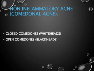 NON INFLAMMATORY ACNE
(COMEDONAL ACNE):
• CLOSED COMEDONES (WHITEHEADS)
• OPEN COMEDONES (BLACKHEADS)
 