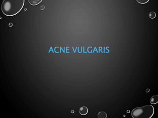 ACNE VULGARIS
 