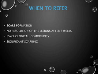 WHEN TO REFER
• SCARS FORMATION
• NO RESOLUTION OF THE LESIONS AFTER 8 WEEKS
• PSYCHOLOGICAL COMORBIDITY
• SIGNIFICANT SCARRING
 