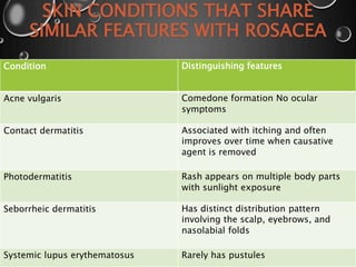 SKIN CONDITIONS THAT SHARE
SIMILAR FEATURES WITH ROSACEA
Distinguishing featuresCondition
Comedone formation No ocular
symptoms
Acne vulgaris
Associated with itching and often
improves over time when causative
agent is removed
Contact dermatitis
Rash appears on multiple body parts
with sunlight exposure
Photodermatitis
Has distinct distribution pattern
involving the scalp, eyebrows, and
nasolabial folds
Seborrheic dermatitis
Rarely has pustulesSystemic lupus erythematosus
 