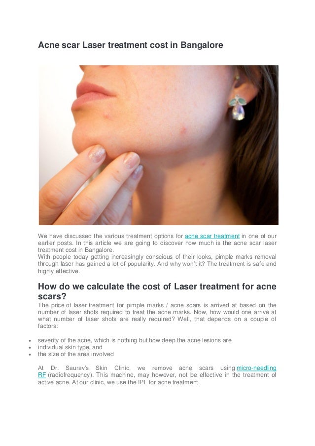 Acne Scar Laser Treatment cost in Bangalore What is the cost of laser