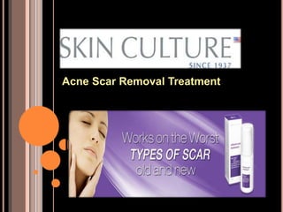 Acne Scar Removal Treatment
 