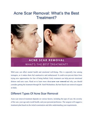 Acne Scar Removal: What’s the Best
Treatment?
Mild acne can affect mental health and emotional well-being. This is especially true among
teenagers, as it makes them feel unattractive and embarrassed. It could even prevent them from
trying new opportunities for fear of being bullied. Early treatment can help prevent emotional
distress and acne scars. Read on to learn more about acne scar removal and why you should
consider getting the treatment through Dr. Sunil Richardson, the best facial scar removal surgeon
in India.
Different Types Of Acne Scar Removal
Acne scar removal treatment depends on various factors, including the type of scar, the severity
of the scar, your age and overall health, and your personal preference. The surgeon will suggest a
treatment plan based on the initial examination and after understanding your requirements.
 