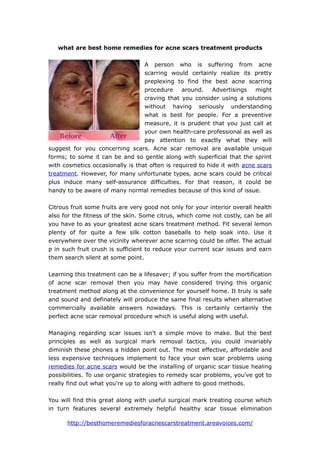 what are best home remedies for acne scars treatment products

                                  A person who is suffering from acne
                                  scarring would certainly realize its pretty
                                  preplexing to find the best acne scarring
                                  procedure     around.    Advertisings   might
                                  craving that you consider using a solutions
                                  without having seriously understanding
                                  what is best for people. For a preventive
                                  measure, it is prudent that you just call at
                                  your own health-care professional as well as
                                  pay attention to exactly what they will
suggest for you concerning scars. Acne scar removal are available unique
forms; to some it can be and so gentle along with superficial that the sprint
with cosmetics occasionally is that often is required to hide it with acne scars
treatment. However, for many unfortunate types, acne scars could be critical
plus induce many self-assurance difficulties. For that reason, it could be
handy to be aware of many normal remedies because of this kind of issue.

Citrous fruit some fruits are very good not only for your interior overall health
also for the fitness of the skin. Some citrus, which come not costly, can be all
you have to as your greatest acne scars treatment method. Fit several lemon
plenty of for quite a few silk cotton baseballs to help soak into. Use it
everywhere over the vicinity wherever acne scarring could be offer. The actual
p in such fruit crush is sufficient to reduce your current scar issues and earn
them search silent at some point.

Learning this treatment can be a lifesaver; if you suffer from the mortification
of acne scar removal then you may have considered trying this organic
treatment method along at the convenience for yourself home. It truly is safe
and sound and definately will produce the same final results when alternative
commercially available answers nowadays. This is certainly certainly the
perfect acne scar removal procedure which is useful along with useful.

Managing regarding scar issues isn't a simple move to make. But the best
principles as well as surgical mark removal tactics, you could invariably
diminish these phones a hidden point out. The most effective, affordable and
less expensive techniques implement to face your own scar problems using
remedies for acne scars would be the installing of organic scar tissue healing
possibilities. To use organic strategies to remedy scar problems, you've got to
really find out what you're up to along with adhere to good methods.

You will find this great along with useful surgical mark treating course which
in turn features several extremely helpful healthy scar tissue elimination

      http://besthomeremediesforacnescarstreatment.areavoices.com/
 