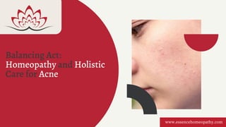 Balancing Act:
Homeopathy and Holistic
Care for Acne
www.essencehomeopathy.com
 