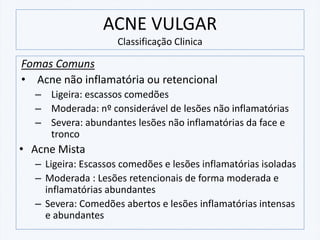 ACNE VULGAR
Classificação Clinica
Fomas Comuns
• Acne não inflamatória ou retencional
– Ligeira: escassos comedões
– Moderada: nº considerável de lesões não inflamatórias
– Severa: abundantes lesões não inflamatórias da face e
tronco
• Acne Mista
– Ligeira: Escassos comedões e lesões inflamatórias isoladas
– Moderada : Lesões retencionais de forma moderada e
inflamatórias abundantes
– Severa: Comedões abertos e lesões inflamatórias intensas
e abundantes
 