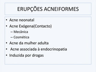 ERUPÇÕES ACNEIFORMES
• Acne neonatal
• Acne Exógena(Contacto)
– Mecânica
– Cosmética
• Acne da mulher adulta
• Acne associada à endocrinopatia
• Induzida por drogas
 