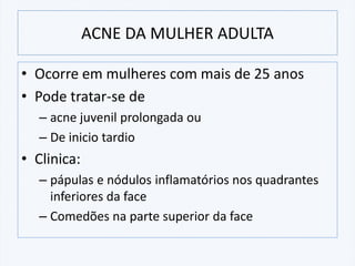 • Ocorre em mulheres com mais de 25 anos
• Pode tratar-se de
– acne juvenil prolongada ou
– De inicio tardio
• Clinica:
– pápulas e nódulos inflamatórios nos quadrantes
inferiores da face
– Comedões na parte superior da face
ACNE DA MULHER ADULTA
 