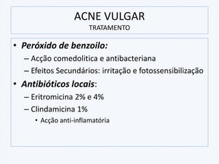 • Peróxido de benzoilo:
– Acção comedolitica e antibacteriana
– Efeitos Secundários: irritação e fotossensibilização
• Antibióticos locais:
– Eritromicina 2% e 4%
– Clindamicina 1%
• Acção anti-inflamatória
ACNE VULGAR
TRATAMENTO
 