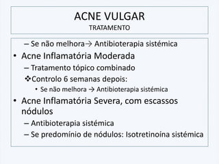 ACNE VULGAR
TRATAMENTO
– Se não melhora→ Antibioterapia sistémica
• Acne Inflamatória Moderada
– Tratamento tópico combinado
❖Controlo 6 semanas depois:
• Se não melhora → Antibioterapia sistémica
• Acne Inflamatória Severa, com escassos
nódulos
– Antibioterapia sistémica
– Se predomínio de nódulos: Isotretinoína sistémica
 