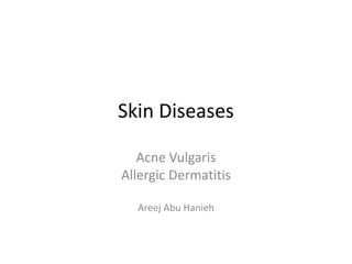 Skin Diseases
Acne Vulgaris
Allergic Dermatitis
Areej Abu Hanieh
 