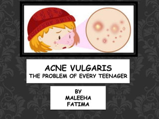 ACNE VULGARIS
THE PROBLEM OF EVERY TEENAGER
BY
MALEEHA
FATIMA
 