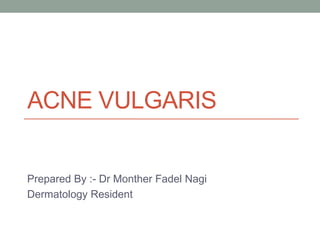ACNE VULGARIS
Prepared By :- Dr Monther Fadel Nagi
Dermatology Resident
 