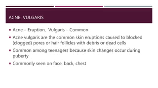 View of Cystic Acne: What Is It, Symptoms, Causes and Treatment