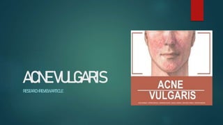 ACNEVULGARIS
RESEARCHREVIEWARTICLE
 
