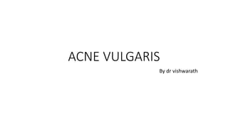 ACNE VULGARIS
By dr vishwarath
 