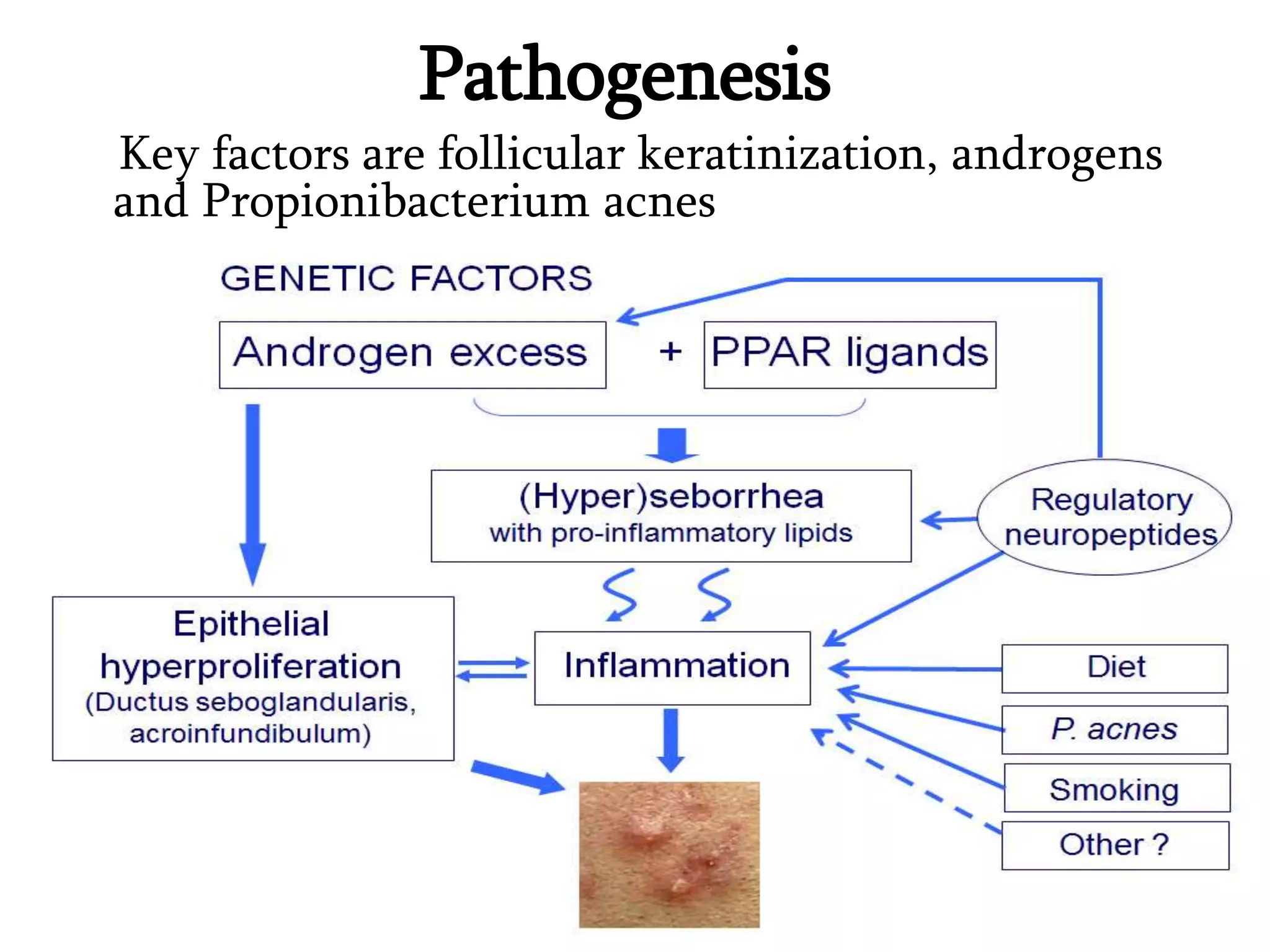 Acne vulgaris....pptx