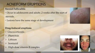 Acne vulgaris [autosaved] | PPTX