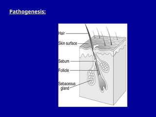Sebaceous Pustules Acne Vulgaris is a chronic inflammatory disease of the pilosebaceous ...