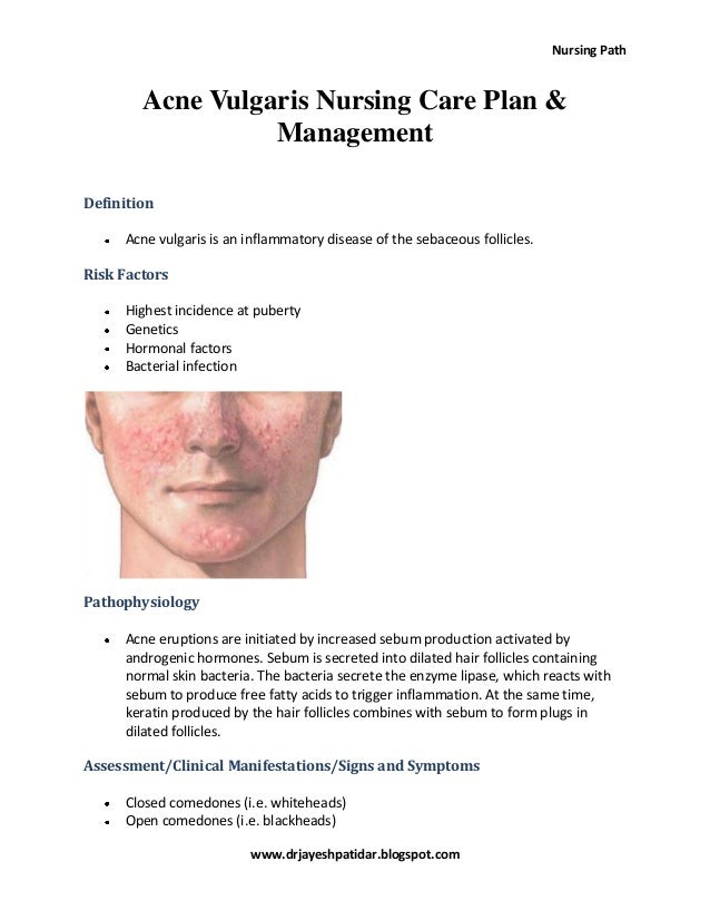 Acne Vulgaris Nursing Care Plan Amp Management