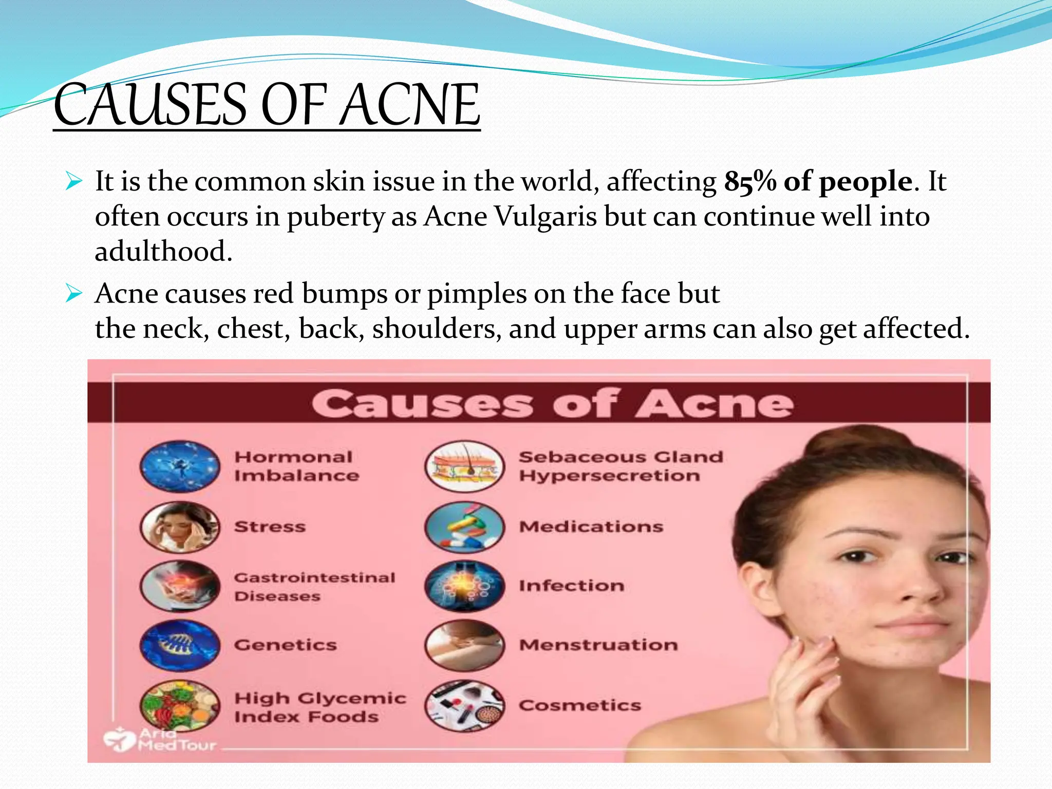 CAUSES OF ACNE
 It is the common skin issue in the world, affecting 85% of people. It
often occurs in puberty as Acne Vulgaris but can continue well into
adulthood.
 Acne causes red bumps or pimples on the face but
the neck, chest, back, shoulders, and upper arms can also get affected.
 