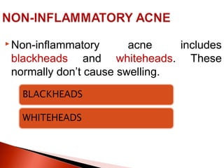Non Inflamed Acne vulgarispresentation | PPT