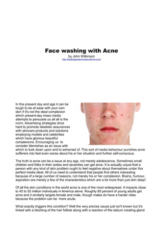 Face washing with Acne
                                      by John Wilkinson
                                 http://bedbugsexterminationadvice.com/




In this present day and age it can be
tough to be at ease with your own
skin if it's not the ideal complexion
which present-day mass media
attempts to persuade us all all is the
norm. Advertising strategies drive
hard to promote idealistic assurances
with skincare products and solutions
employing models and celebrities
which have glorious beautiful
complexions. Encouraging us to
consider blemishes as an issue with
which to look down upon and to ashamed of. This sort of media behaviour punishes acne
sufferers into feel even worse about his or her situation and further self-conscious.

The truth is acne can be a issue at any age, not merely adolescence. Sometimes small
children and folks in their sixties and seventies can get acne. It is actually unjust that a
person with any kind of skin problem ought to feel negative about themselves under this
perfect media ideal. All of us need to understand that people find others interesting
because of a large number of reasons, not merely his or her complexion. Brains, humour,
aspiration are merely a few of the characteristics which are a lot more than just skin deep!

Of all the skin conditions in the world acne is one of the most widespread. It impacts close
to 45 to 55 million individuals in America alone. Roughly 80 percent of young adults get
acne and it similarly targets female and male, though males do have a harder rides
because the problem can be more acute.

What exactly triggers this condition? Well the very precise cause just isn't known but it's
linked with a blocking of the hair follicle along with a reaction of the sebum creating gland
 