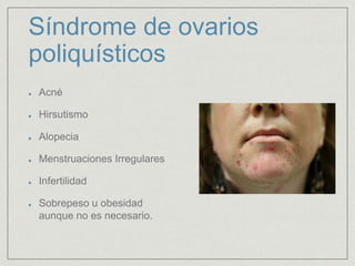 Síndrome de ovarios 
poliquísticos 
Acné 
Hirsutismo 
Alopecia 
Menstruaciones Irregulares 
Infertilidad 
Sobrepeso u obesidad 
aunque no es necesario. 
 