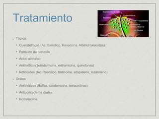 Tratamiento 
Tópico 
• Queratolíticos (Ac. Salícilico, Resorcina, Alfahidroxiácidos) 
• Peróxido de benzoilo 
• Ácido azelaico 
• Antibióticos (clindamicina, eritromicina, quinolonas) 
• Retinoides (Ac. Retinóico, tretinoina, adapaleno, tazaroteno) 
Orales 
• Antibióticos (Sulfas, clindamicina, tetraciclinas) 
• Anticonceptivos orales 
• Isotretinoina. 
 