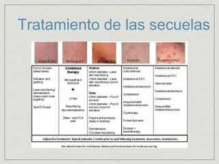 Tratamiento de las secuelas 
 