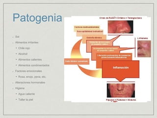 Patogenia 
Sol 
Alimentos irritantes 
• Chile rojo 
• Alcohol 
• Alimentos calientes 
• Alimentos condimentados 
Factores emocionales 
• Rosa, enojo, pena, etc. 
Alteraciones hormonales 
Higiene 
• Agua caliente 
• Tallar la piel 
 