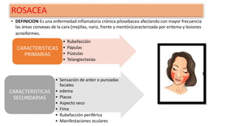 ROSACEA
• DEFINICION-Es una enfermedad inflamatoria crónica pilosebacea afectando con mayor frecuencia
las áreas convexas de la cara (mejillas, nariz, frente y mentón)caracterizada por eritema y lesiones
acneiformes.
• Rubefacción
• Pápulas
• Pústulas
• Telangiectasias
CARACTERISTICAS
PRIMARIAS
• Sensación de ardor o punzadas
faciales
• edema
• Placas
• Aspecto seco
• Fima
• Rubefacción periférica
• Manifestaciones oculares
CARACTERISTICAS
SECUNDARIAS
 