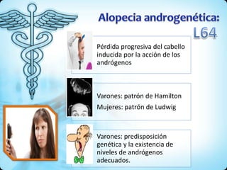Pérdida progresiva del cabello
inducida por la acción de los
andrógenos
Varones: patrón de Hamilton
Mujeres: patrón de Ludwig
Varones: predisposición
genética y la existencia de
niveles de andrógenos
adecuados.
 