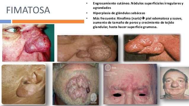Is eurax over the counter - Farmacia