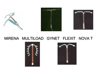 MIRENA MULTILOAD GYNET FLEXIT NOVA T
 