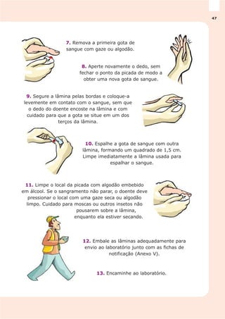 13. Encaminhe ao laboratório.
12. Embale as lâminas adequadamente para
envio ao laboratório junto com as fichas de
notificação (Anexo V).
10. Espalhe a gota de sangue com outra
lâmina, formando um quadrado de 1,5 cm.
Limpe imediatamente a lâmina usada para
espalhar o sangue.
9. Segure a lâmina pelas bordas e coloque-a
levemente em contato com o sangue, sem que
o dedo do doente encoste na lâmina e com
cuidado para que a gota se situe em um dos
terços da lâmina.
8. Aperte novamente o dedo, sem
fechar o ponto da picada de modo a
obter uma nova gota de sangue.
7. Remova a primeira gota de
sangue com gaze ou algodão.
11. Limpe o local da picada com algodão embebido
em álcool. Se o sangramento não parar, o doente deve
pressionar o local com uma gaze seca ou algodão
limpo. Cuidado para moscas ou outros insetos não
pousarem sobre a lâmina,
enquanto ela estiver secando.
47
 
