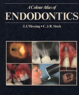 A colour atlas of endodontics