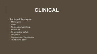 CLINICAL
• Ruptured Aneurysm
• Meningism
• Coma
• Nausea and vomiting
• Headache
• Neurological deficit
• Dysphasia
• Homonymous hemianopia
• Third nerve palsy
 