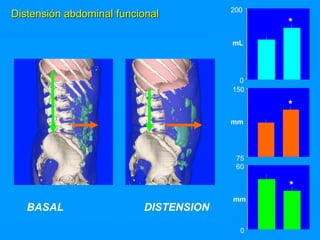 Acomodación abdomino torácica en la distensión abdominal | PDF