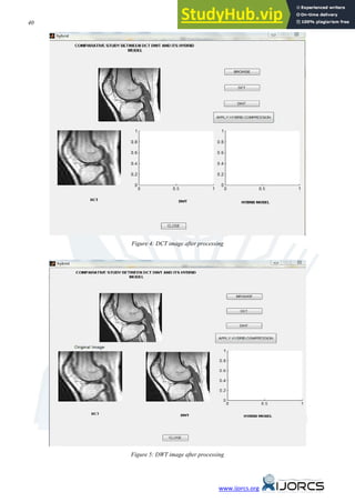 40 Kiran Bindu, Anita Ganpati, Aman Kumar Sharma
www.ijorcs.org
Figure 4: DCT image after processing
Figure 5: DWT image after processing
 