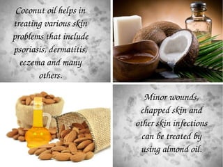 Coconut oil helps in 
treating various skin 
problems that include 
psoriasis, dermatitis, 
eczema and many 
others.
Minor...