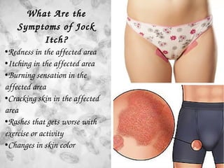 What Are the 
Symptoms of Jock 
Itch?
●Redness in the affected area
●Itching in the affected area
●Burning sensation in th...