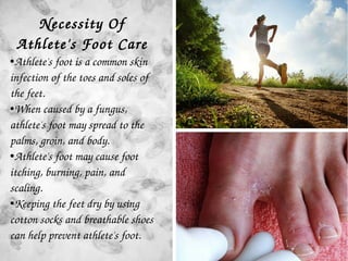 Necessity To Take Care Of Athlete's Foot
Necessity Of 
Athlete's Foot Care
●Athlete's foot is a common skin 
infection of ...