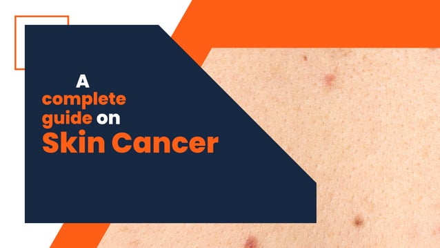 Skin Cancer Clinical Guidelines – FBQA