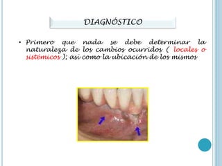 DIAGNÓSTICO
• Primero que nada se debe determinar la
naturaleza de los cambios ocurridos ( locales o
sistémicos ); así como la ubicación de los mismos
 