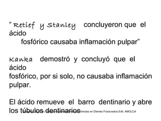 “ Retief y Stanley concluyeron que el
ácido
fosfórico causaba inflamación pulpar”
Kanka demostró y concluyó que el
ácido
fosfórico, por si solo, no causaba inflamación
pulpar.
El ácido remueve el barro dentinario y abre
los túbulos dentinariosBaratieri , LUIZ N./ Restauraciones Adhesivas Directas en Dientes Fracturados.Edit. AMOLCA
 