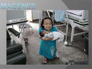  Pantorrillas con forma de arco, pies chicos, anchos y planos.