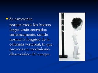 Se caracteriza porque todos los huesos largos están acortados simétricamente, siendo normal la longitud de la columna vertebral, lo que provoca un crecimiento disarmónico del cuerpo. 